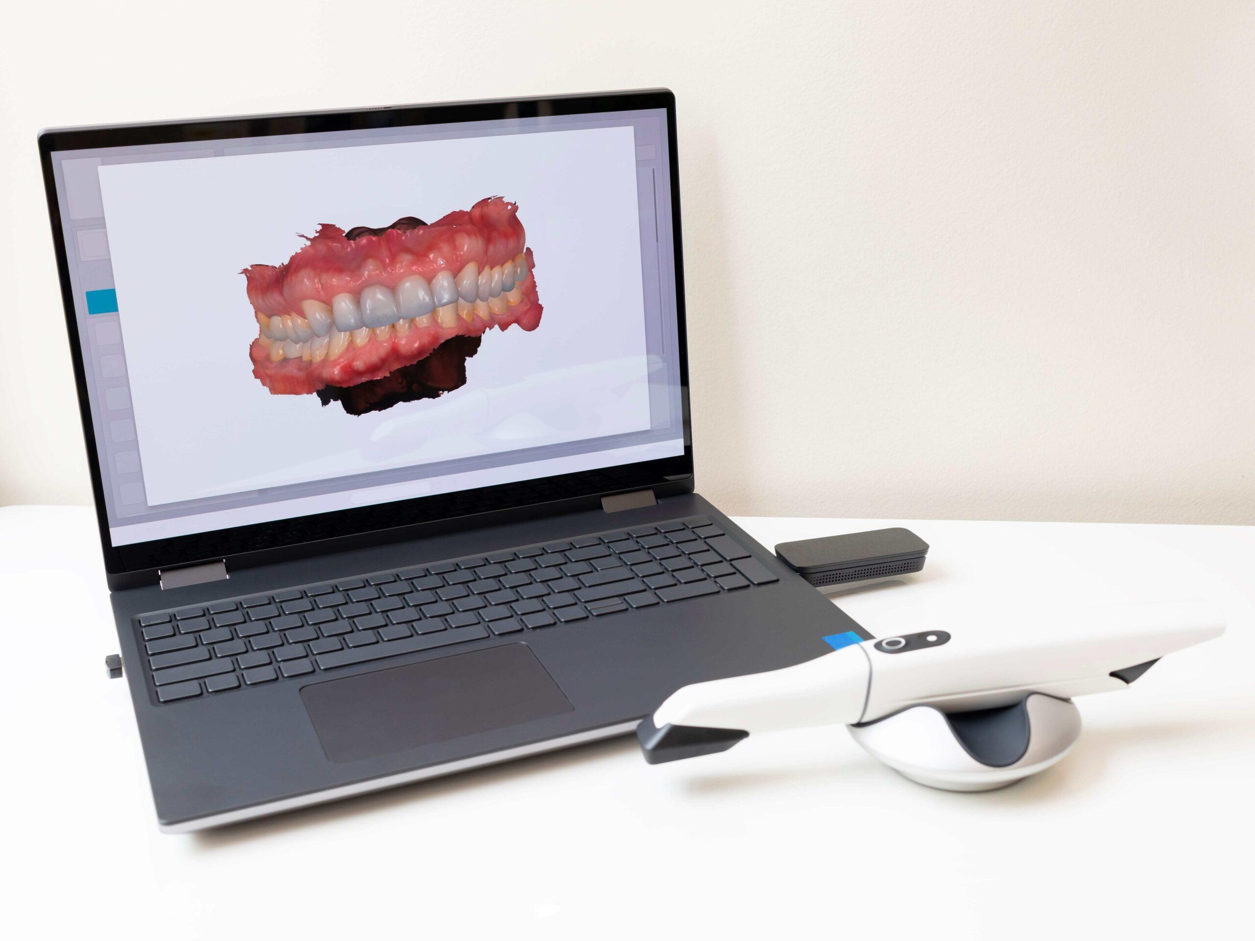 How Can 3D Dental Imaging Enhance My Oral Health?