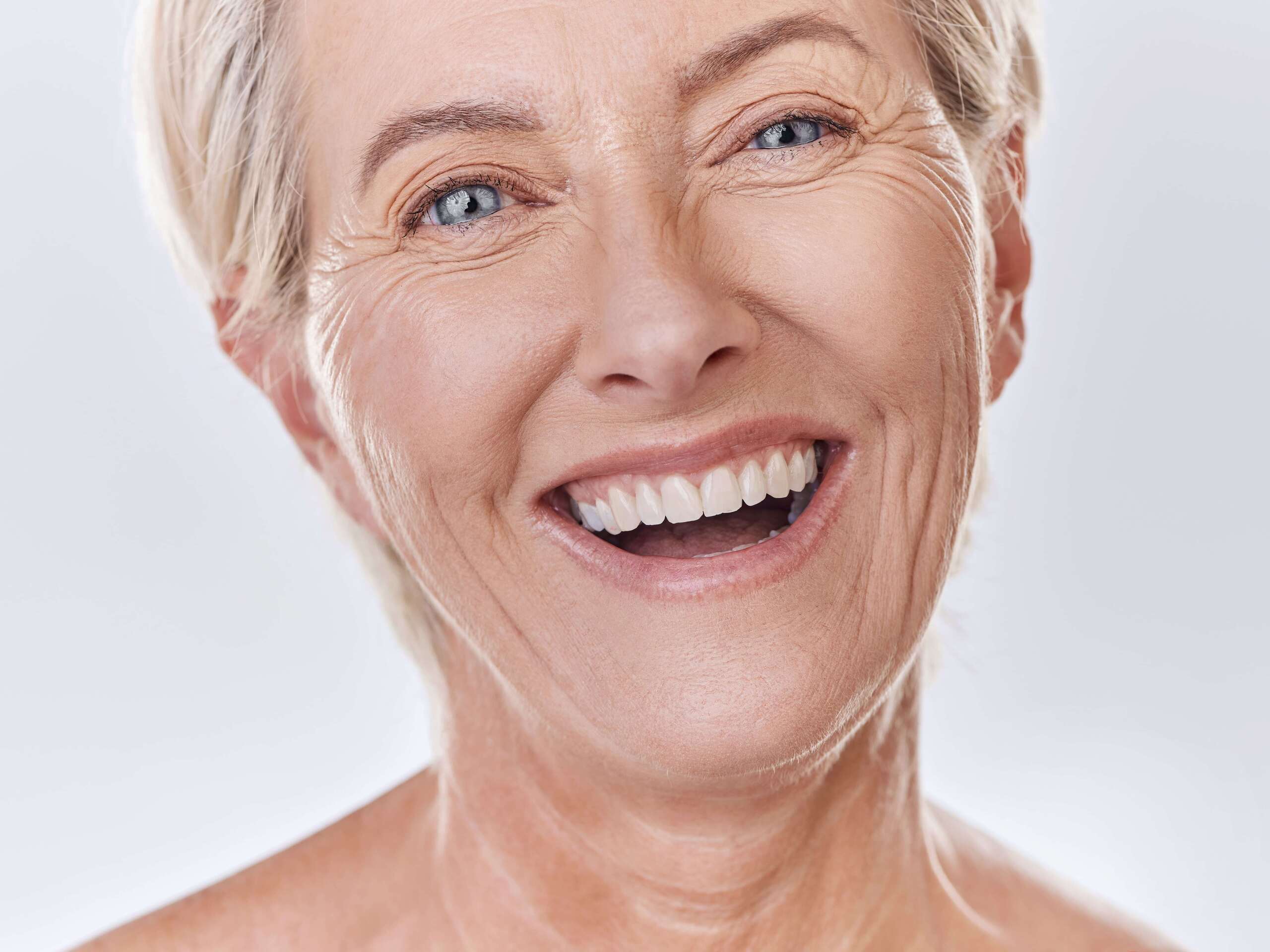 What Are the Benefits of Complete Dentures?