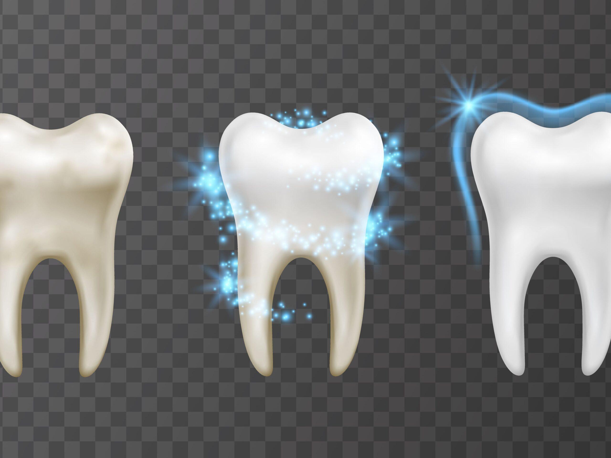 Unlocking a Brighter Smile: Innovative Teeth Whitening Solutions