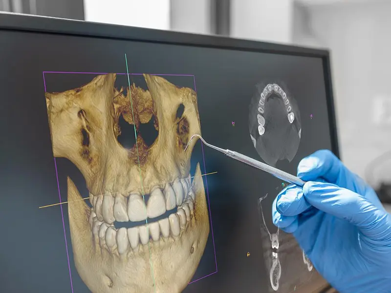 How Can 3D Dental Imaging Enhance Your Oral Health?