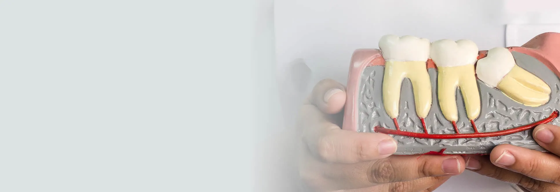 Wisdom teeth removal