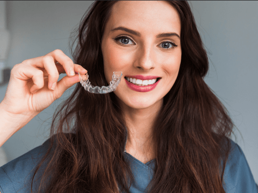 What Are the Benefits of Clear Aligners?