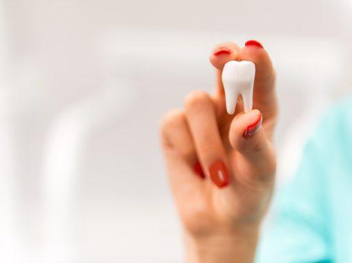 Wisdom Teeth FAQ